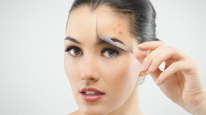 30岁女人脸上长痘痘是什么原因？脸上长痘需要注意什么？