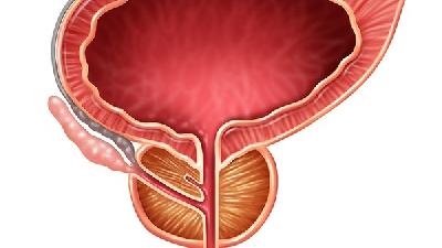 前列腺psa忽高忽低说明什么