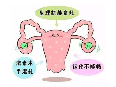 是什么原因引起多囊 o4YBAFzjobiAS9MpAAE481viwZg112.jpg