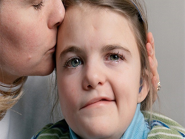 吹空调诱发面瘫的症状 如果出现这3种情况要注