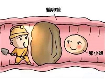 ooYBAF1LwkKAMcqUAACQi_ksBmU463.jpg