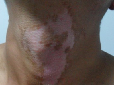 手上热的时候有小白点 o4YBAF1SHj-AVsMGAADmrX0nZBQ309.jpg