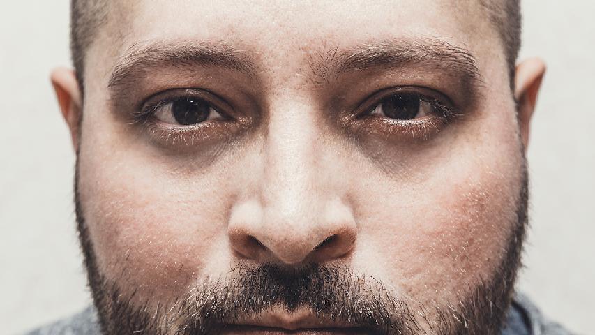 由于长时间在强光下工作，导致视力散光怎么办