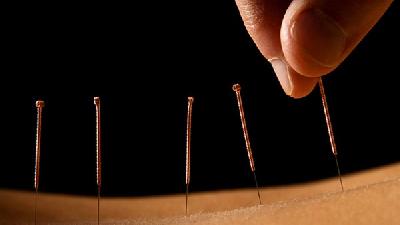 痛风发作该怎么办 治疗方法有哪些