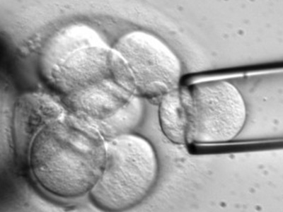 试管移植_试管移植了优质胚胎为什么没怀孕?