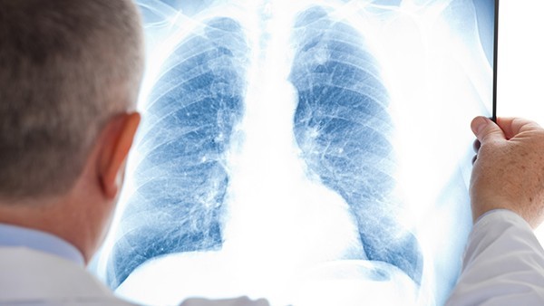 两肺胸膜下间质性炎症是什么