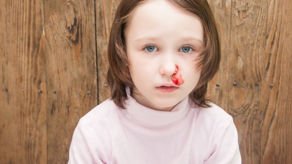 小孩流鼻血是什么原因，怎么治