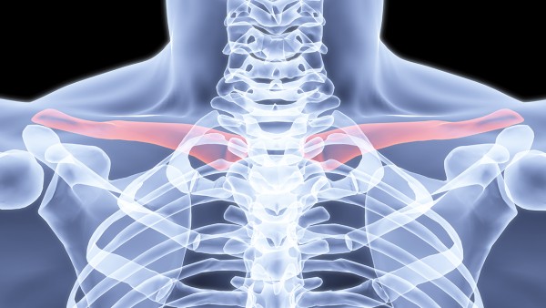 肩关节锁骨下出现条索或片状隆起