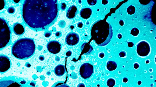 淋巴细胞和中性粒细胞分别代表什么