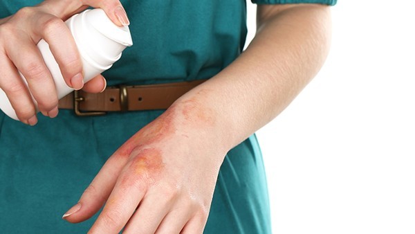 手部热烧伤时，正确的应急处置方法是什么