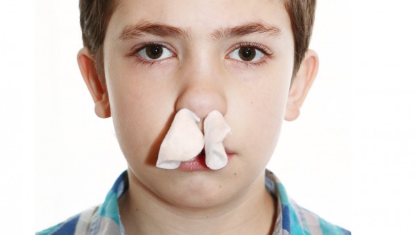 中年人经常流鼻血是什么原因