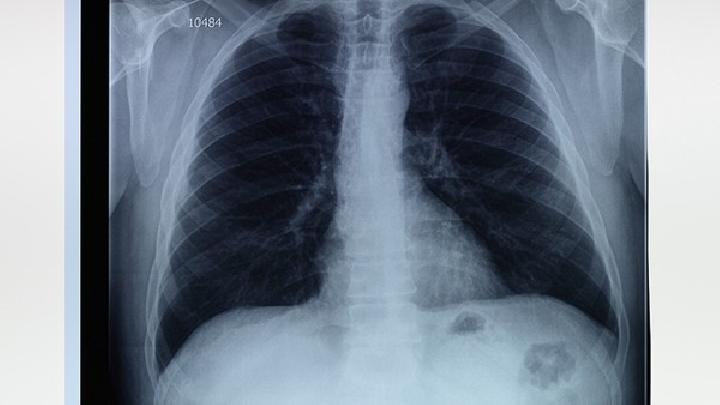 支原体肺炎来势汹汹科学防范勿恐慌