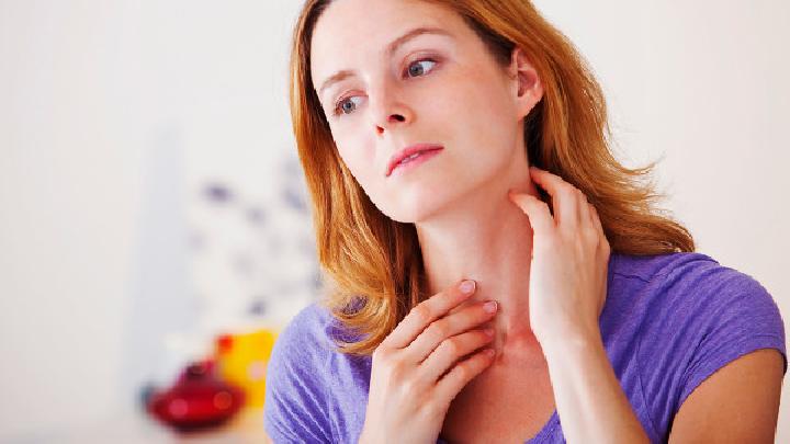 干性湿疹症状是什么？干性湿疹患者不能吃什么？