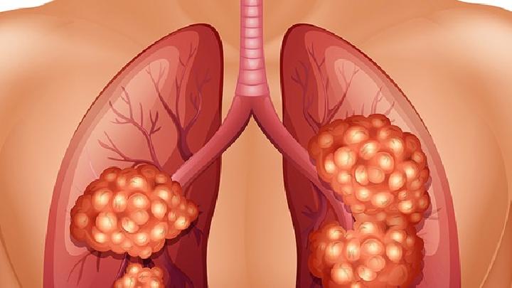 腹泻，37.9℃是不是肺炎感染