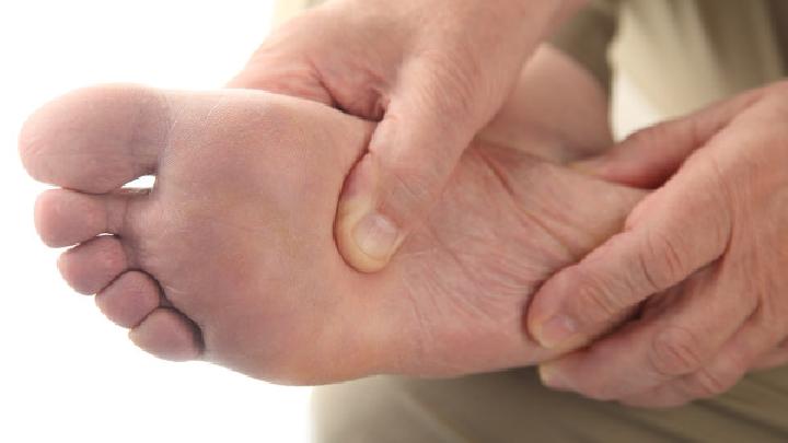 腳腫了如何消腫 這方法你知道嗎
