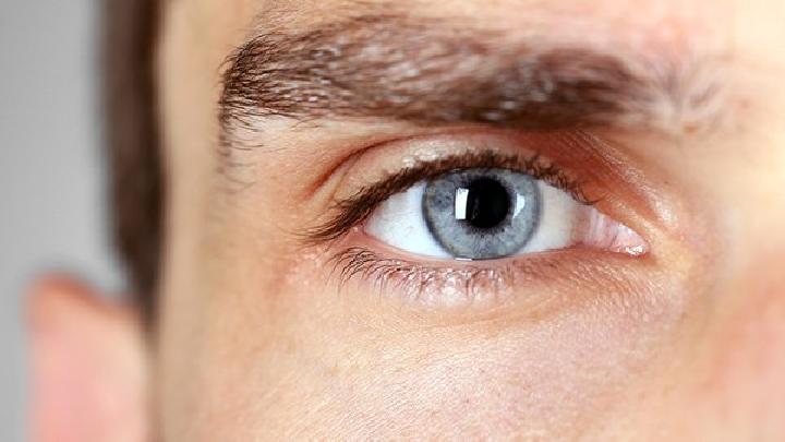 怎样去除干眼症患者的眼屎？方法有哪些？