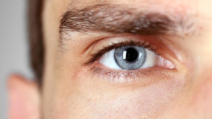 怎樣去除干眼癥患者的眼屎？方法有哪些？