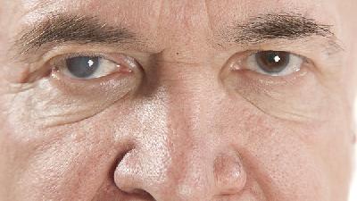 眼科干眼症护理方法有哪些？