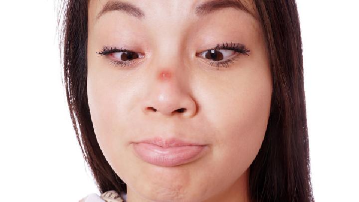 女性经期痘痘疯长怎么办？自制祛痘面膜时刻拥有无暇肌肤