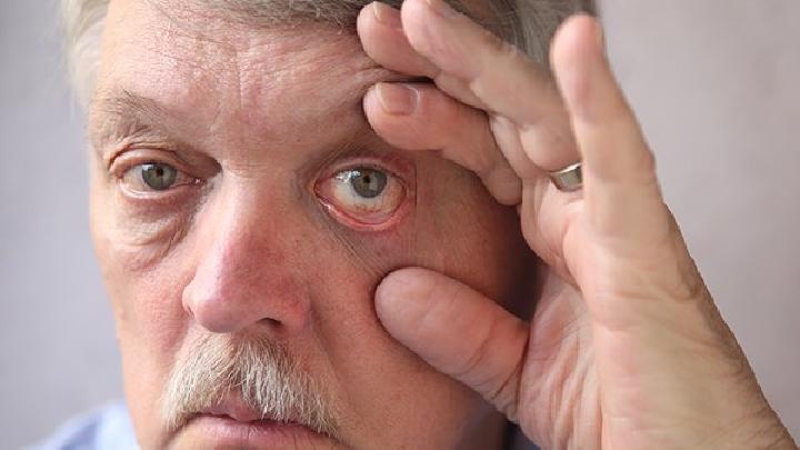 养生吃葡萄好吗？细数葡萄各种养生功能大全！