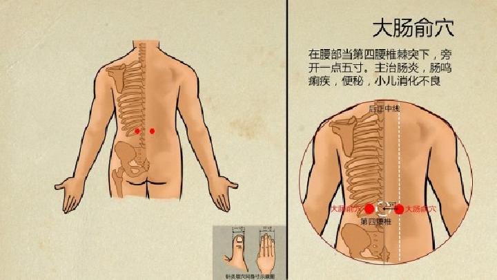 穴位针灸减肥效果好吗？针灸减肥的效果怎么样