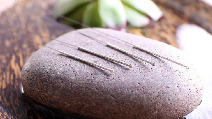 針灸減肥法真的有效嗎 針灸減肥常見(jiàn)的10大穴位