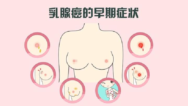 北京市打針豐胸多少錢(qián) 哪個(gè)醫(yī)院門(mén)診豐胸效果好