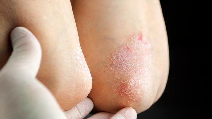 男性常吃3種肉減肥瘦身享輕松