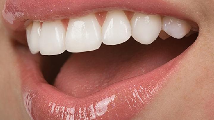 解答:冷光牙齒美白的適應癥有哪些