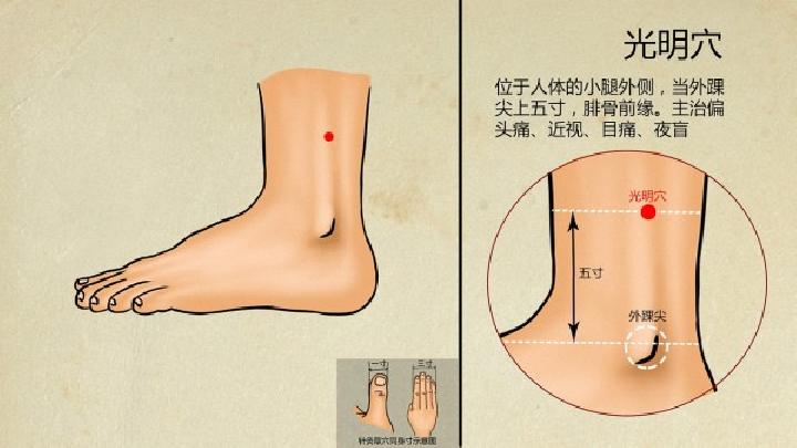 找對穴位拔罐治落枕效果好