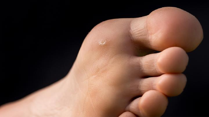 有开眼角不留疤痕的方法吗