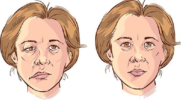 女性除皺最佳年齡30~35歲
