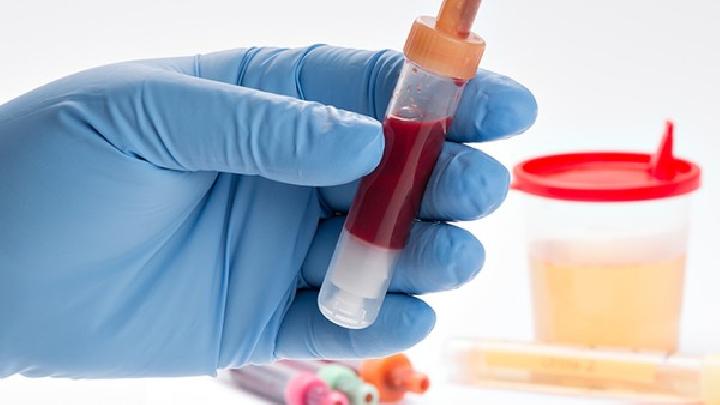 什么时候修复处女膜最合适