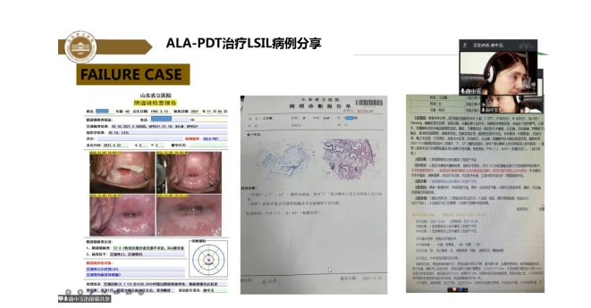 瑞琳他抗—HPV感染疾病与宫颈癌防治研讨会（青岛站）圆满召开