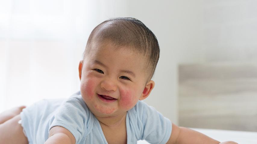婴儿湿疹有哪些典型症状？婴儿湿疹的常见症状表现