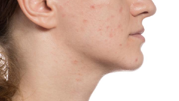夏季如何美白肌膚？夏季美白肌膚的方法