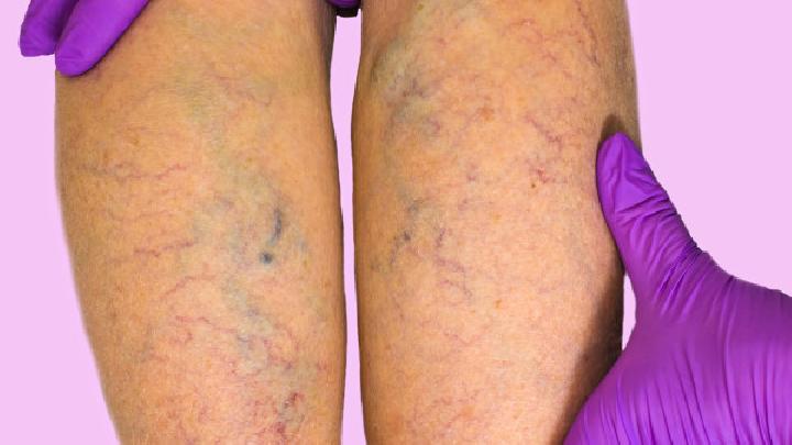 如何快速瘦大腿試試這3種方法