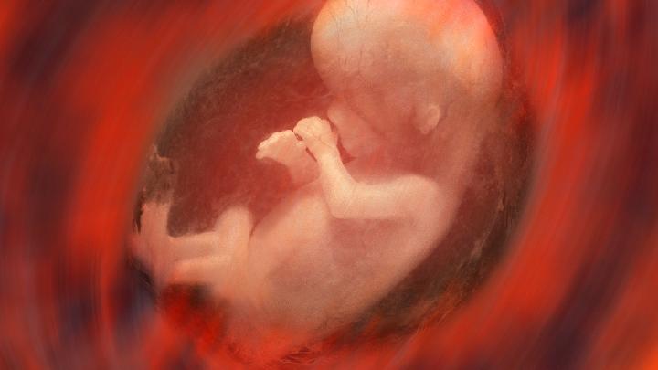 一个月前检查发现胎儿没胎心