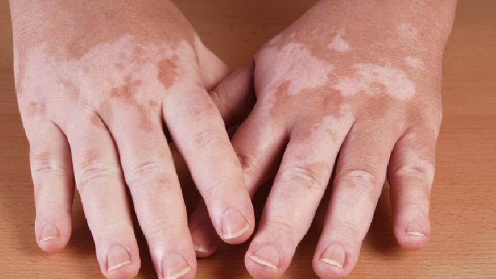 肌肤补水要怎么做 自制补水面膜让您皮肤透亮水嫩