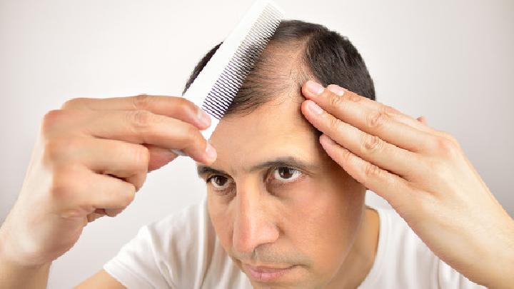 男性脱发的治疗方法有哪些？