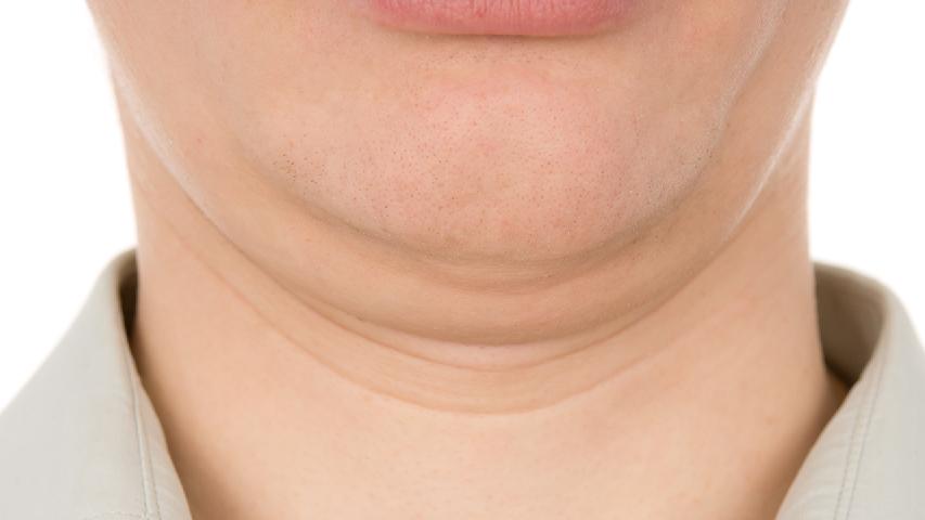 下巴脖子淋巴长痘是什么原因造成？