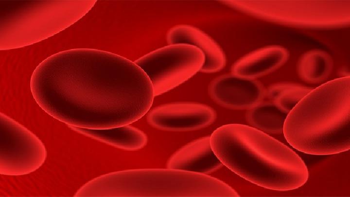 真红细胞增多症检查方法