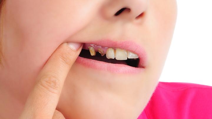 牙痛怎么治中医采用按摩方法