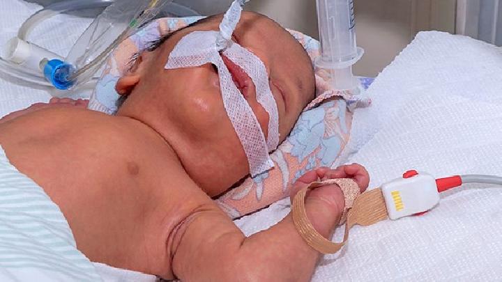 新生儿先天性喉喘鸣可以自愈吗