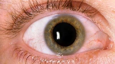 干眼症如何防护 干眼症的按摩治疗