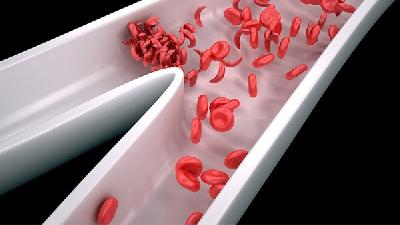 尿常规红细胞偏高，需要进一步复查相关器官功能