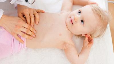 15个多月宝宝有荨麻疹怎么办