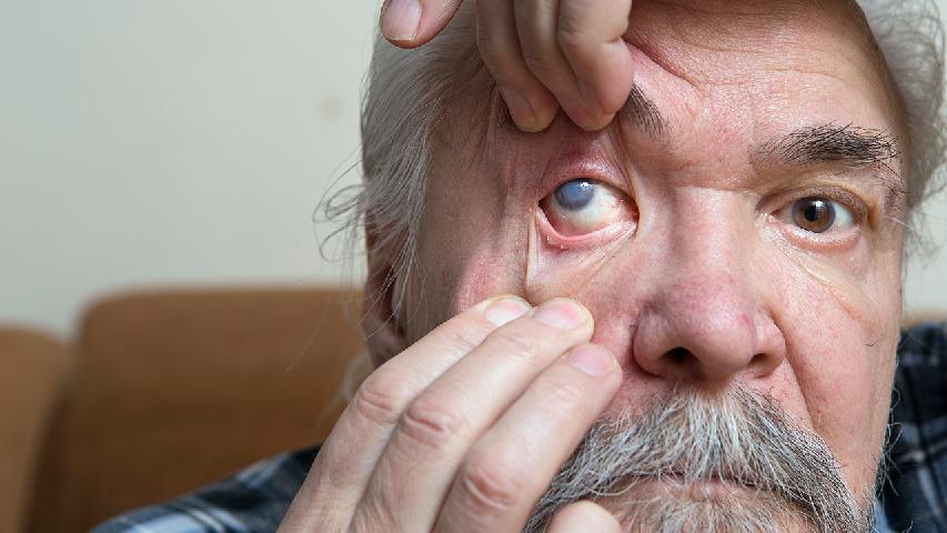 长期看电脑小心得青光眼 青光眼药物治疗