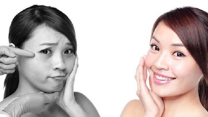 找准根源远离皮肤暗淡 美白不是梦
