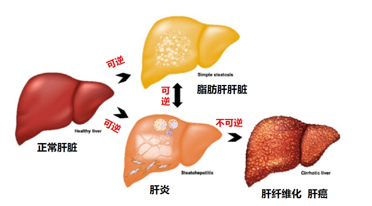 熬夜就是熬肝！LAIFE「乐轻肝」科技配方提升肝脏解毒能力